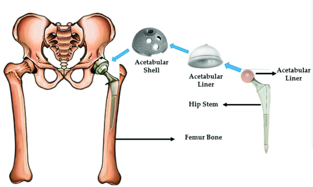 Junsun artificial joints 3